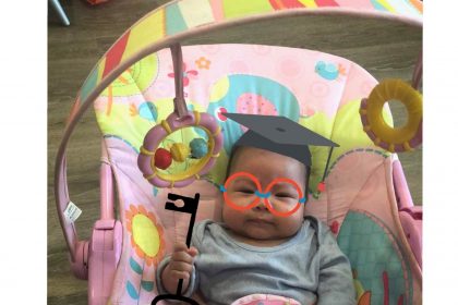 Truyền thuyết giãn dạ dày ư? 6